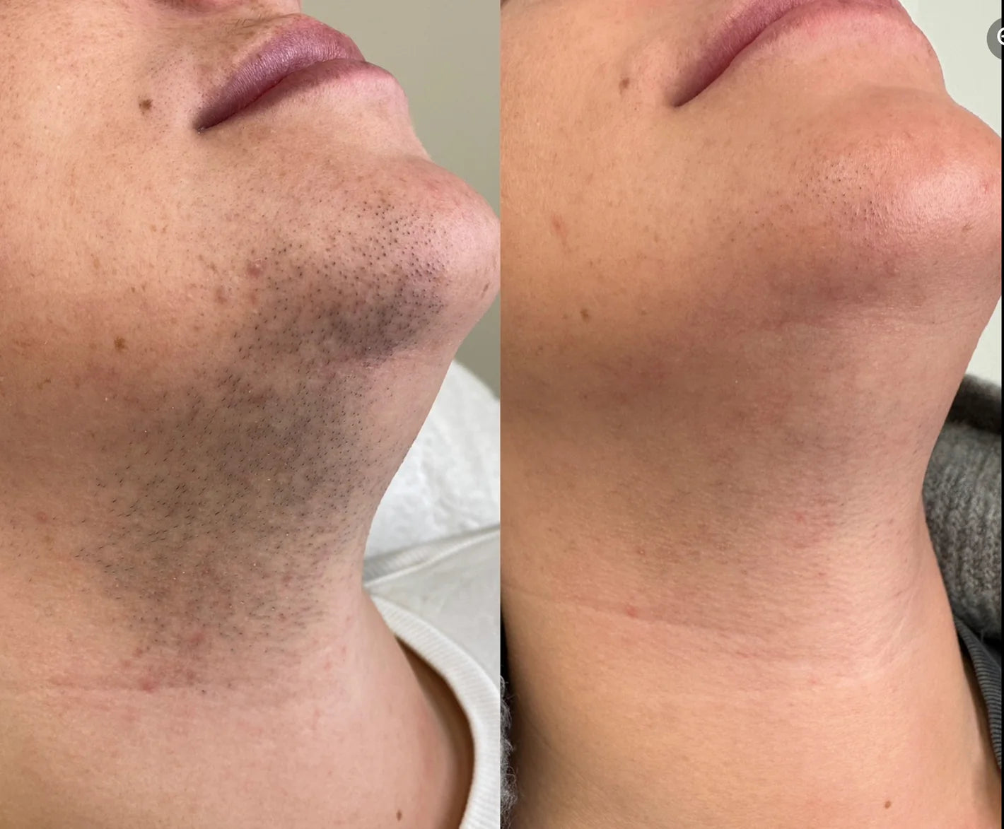 Cyperus Rotundus Skin Serum .
